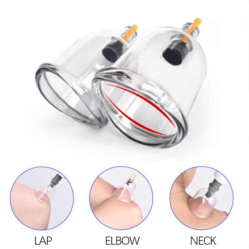 Vacuum Cupping Suction Therapy Device